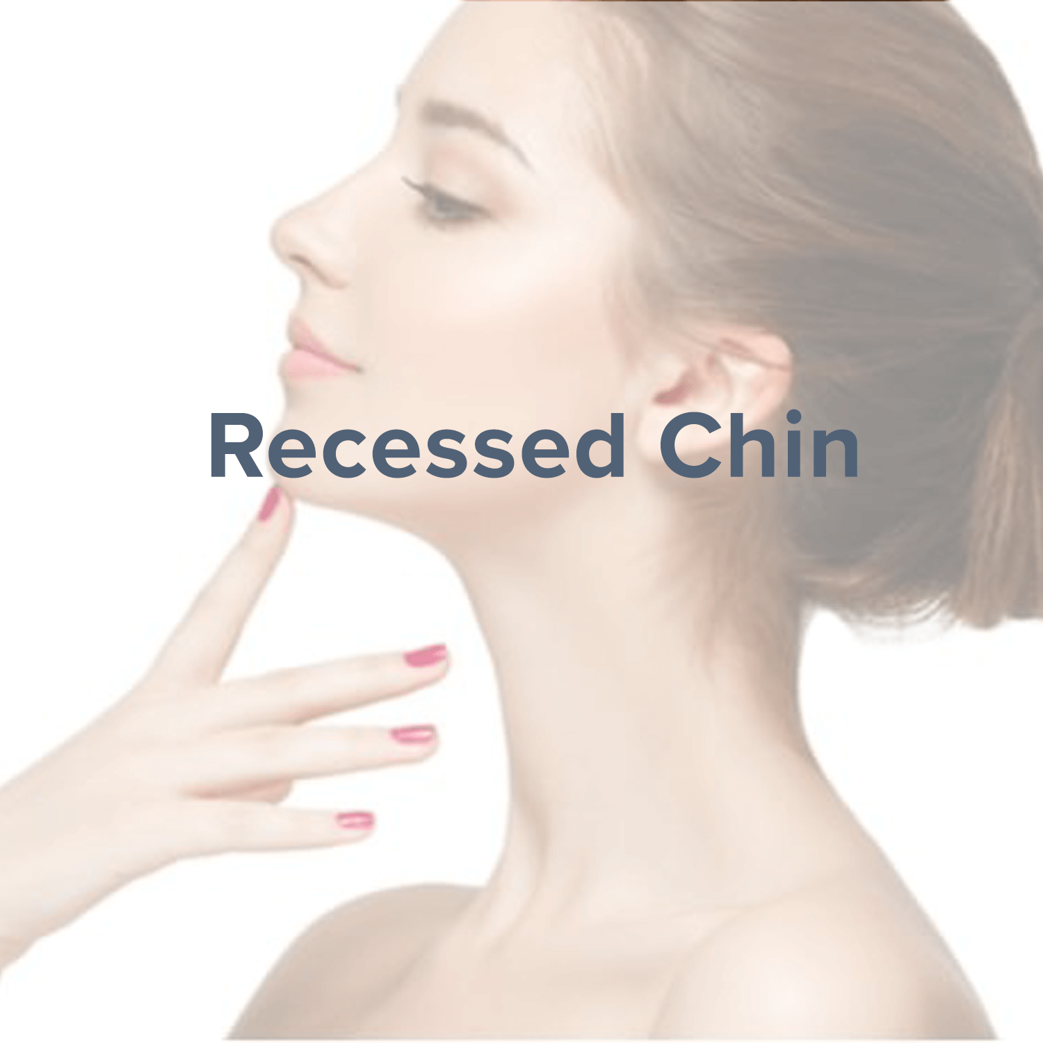 recessed-chin.png