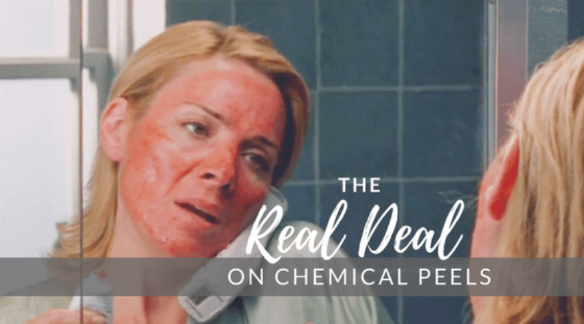 The 7 Most Common Misconception about Chemical Peels — Lazaderm