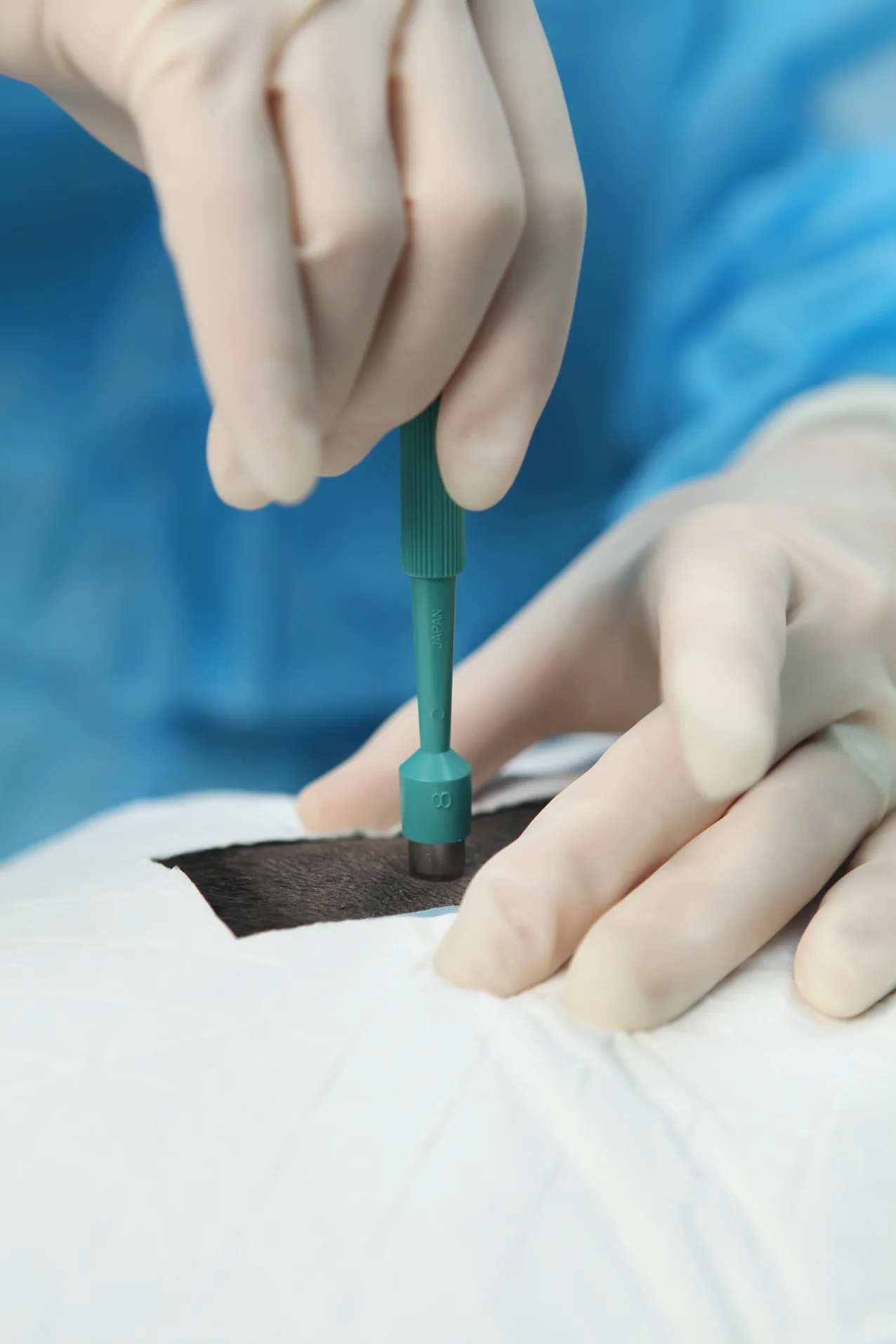 Website 5E Biopsy Close up.JPG