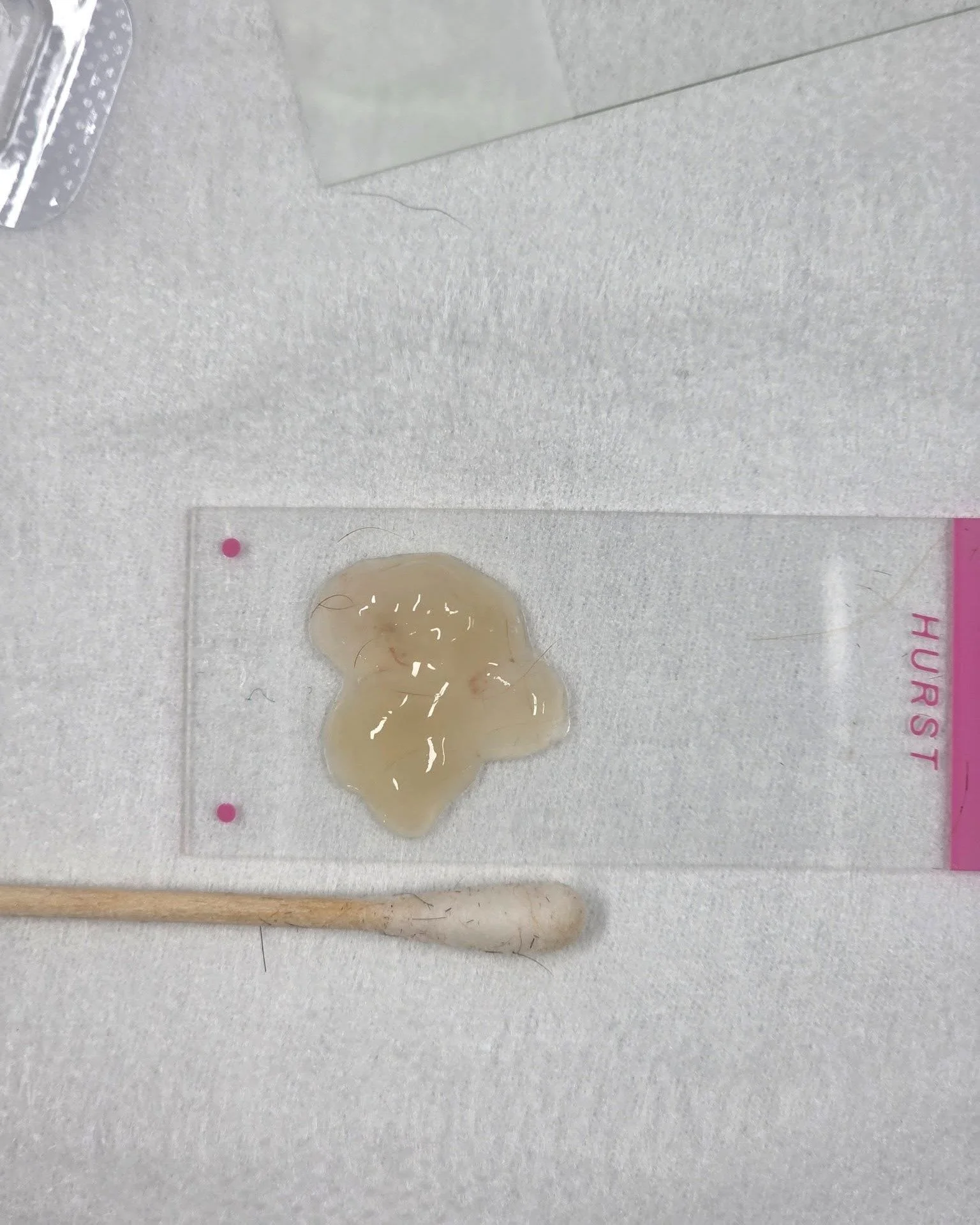 This big mucous plug was flushed out during a video otoscopy ear flush. This procedure lets us look deep inside the ear canal and safely remove and clean out thick debris that&rsquo;s causing discomfort. ✨

Once the ear is cleaned, we can properly as