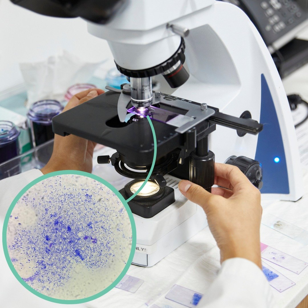 🔬 Things We See Under the Microscope | #WAAW2025 Edition

Rods and Cocci &ndash; A Complicated Combo 🦠🧫

When we examine a cytology sample and spot both rod-shaped and round (cocci) bacteria on the same slide, we know we&rsquo;re dealing with a mo