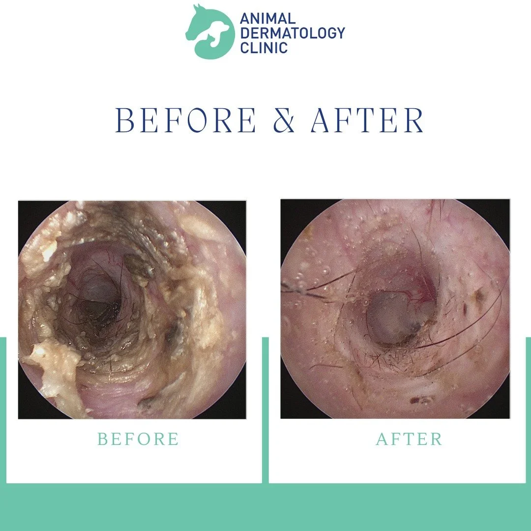 ✨ Before &amp; After Ear Flush ✨

This collage shows the difference a professional ear flush can make. Using advanced video otoscopy, we&rsquo;re able to see deep inside the ear canal, gently remove built-up wax and debris, and properly assess what&r