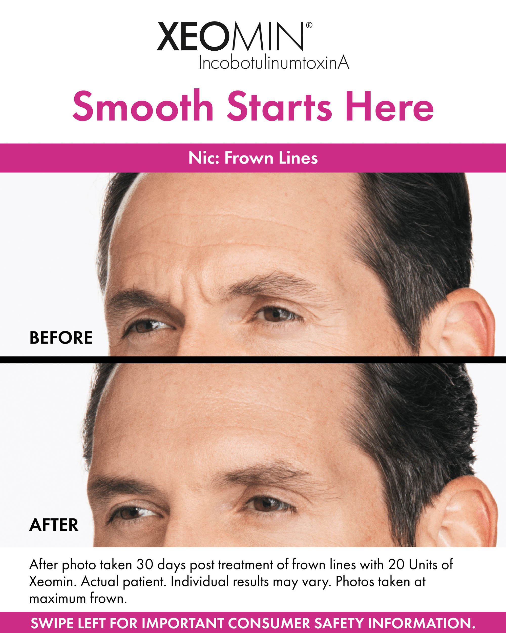 Before&AfterPosts-Nic-1.jpeg