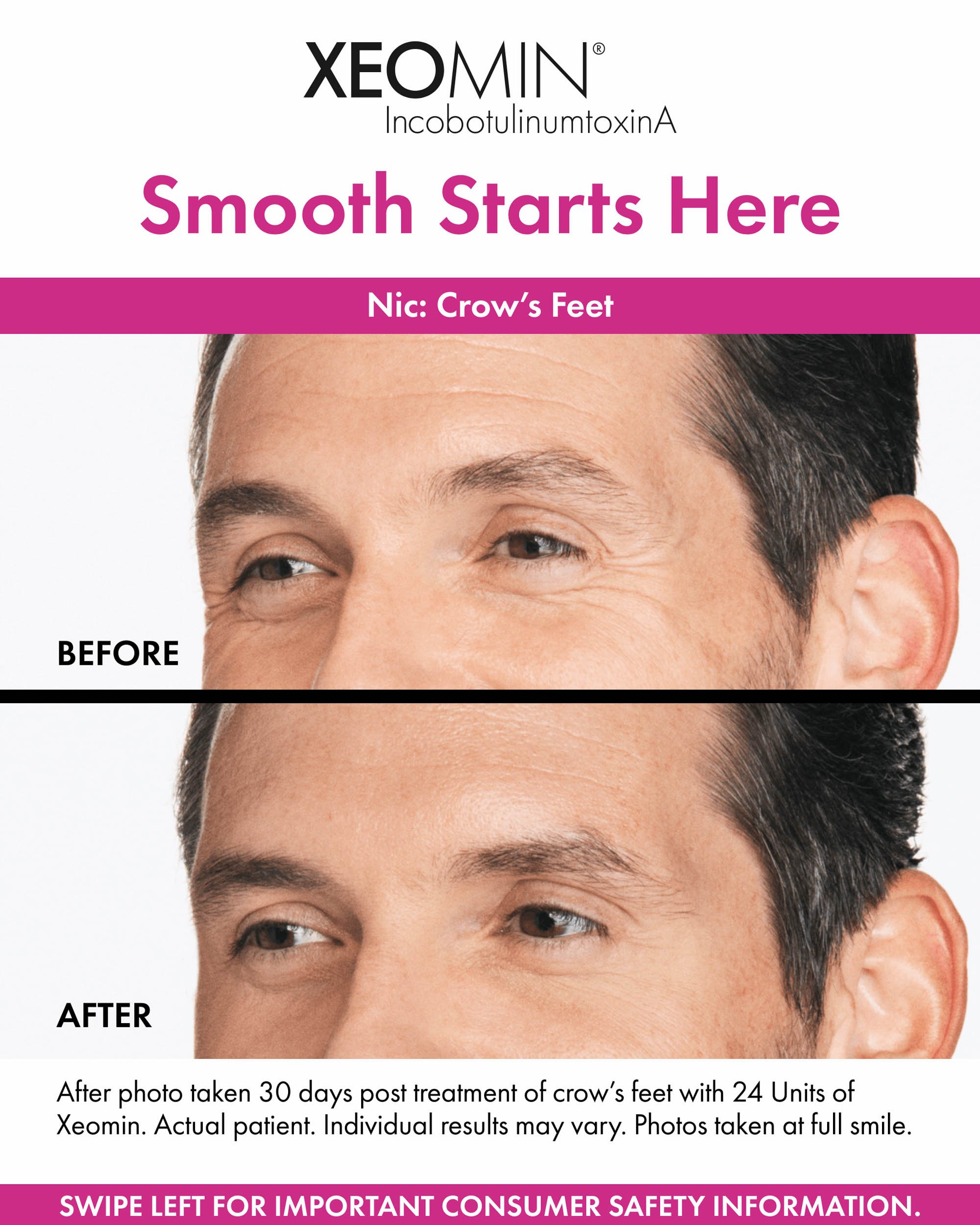 Before&AfterPosts-Nic-2.jpeg