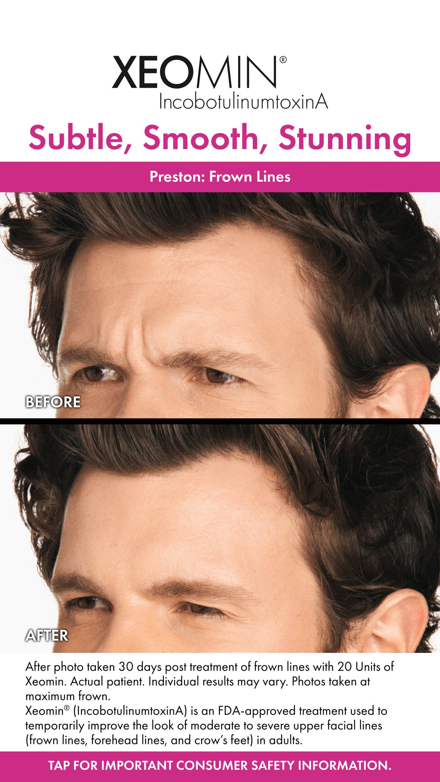 Before&AfterStory-Preston-1.jpeg