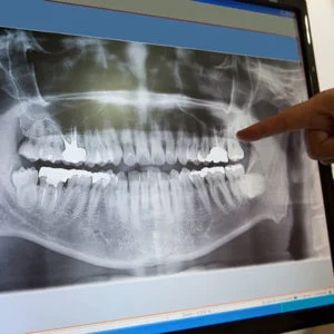 dental-xrays-square-2-300x300.jpg