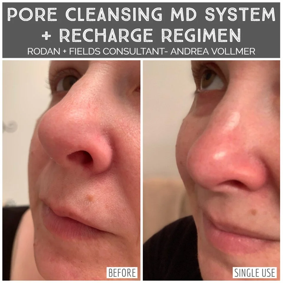 rodan fields pore cleanser