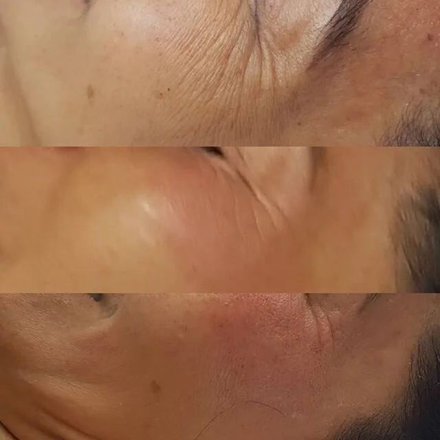Results on the 1st session #antiaging