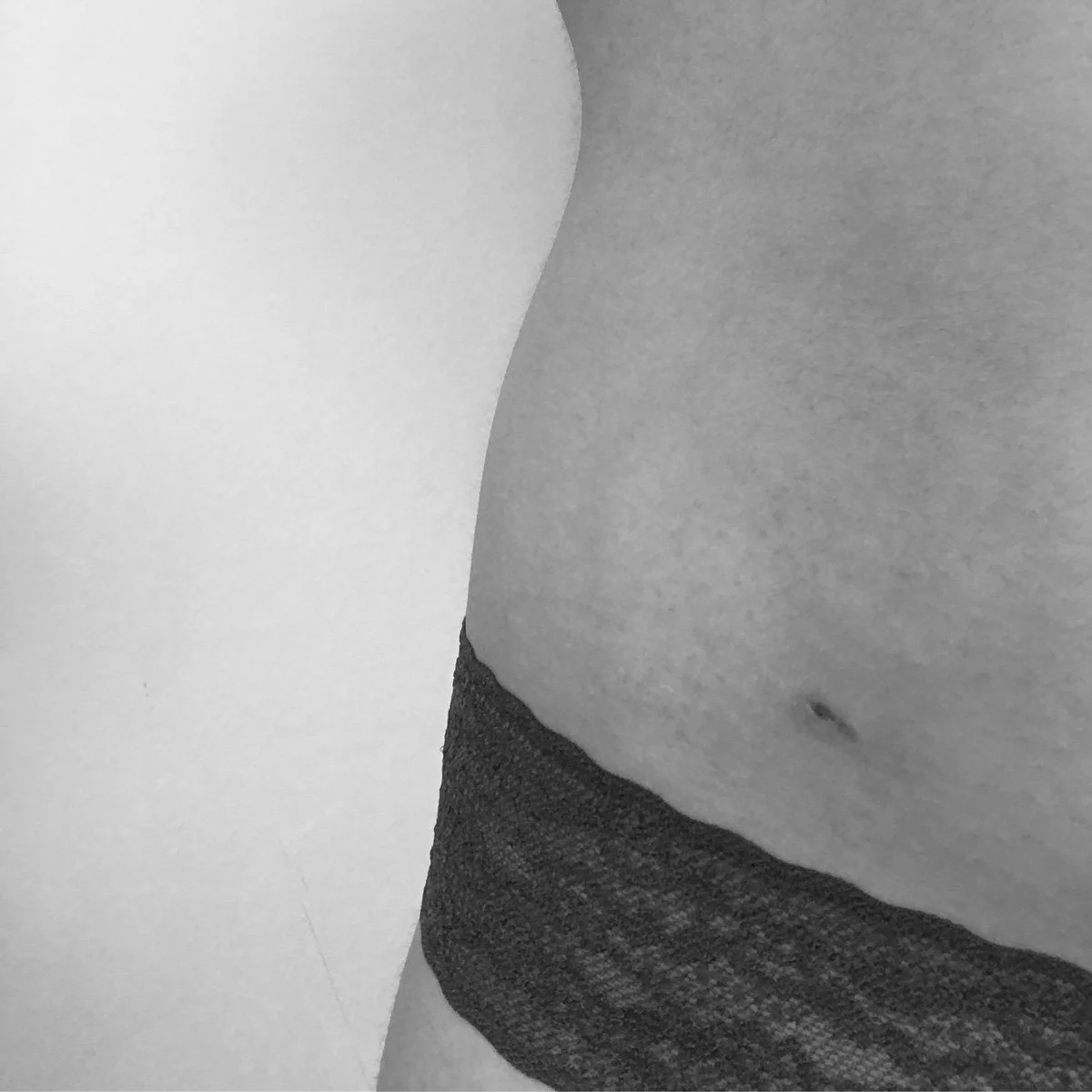 Image of woman's body with scar on the abdomen