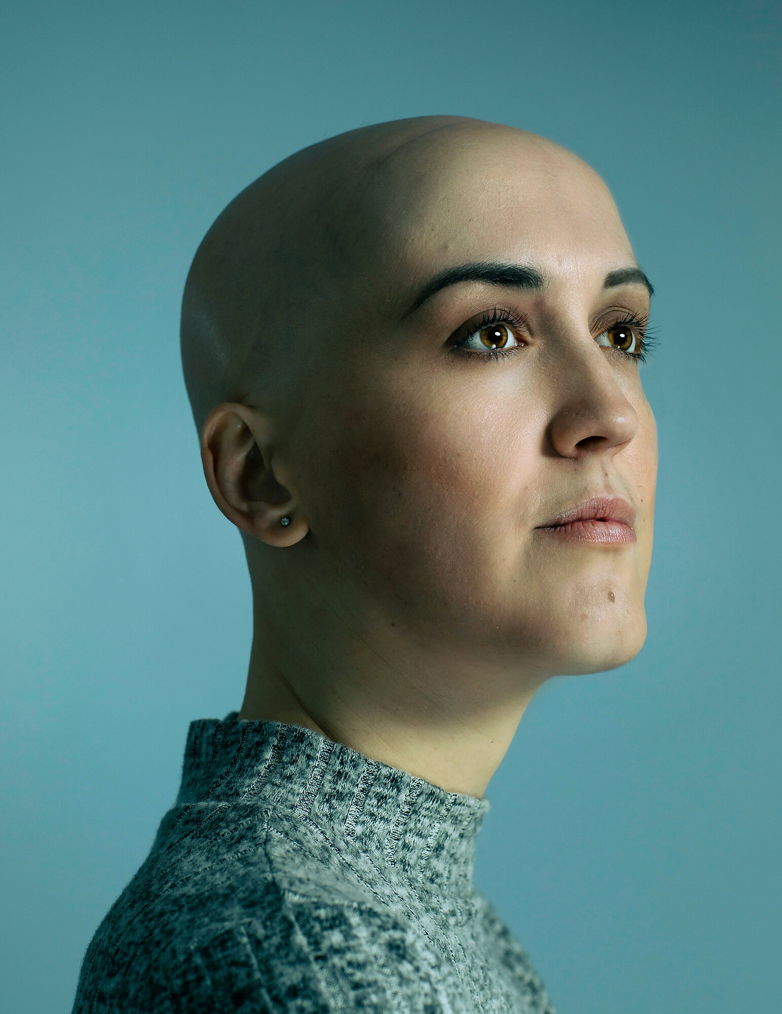  Alice Austin has suffered from Alopecia since the age of nine. Since turning thirty she has stopped wearing her wigs and feels free and liberated whilst also being a role model to her young daughter. Nottingham. Photo: Fabio De Paola, 06 January 202