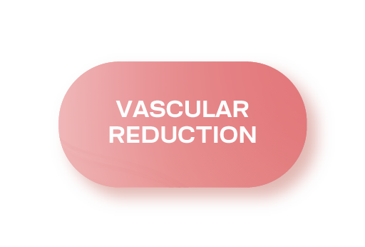 FY-Website-Redesign-Assets-LightTherapy-VascularReduction.png
