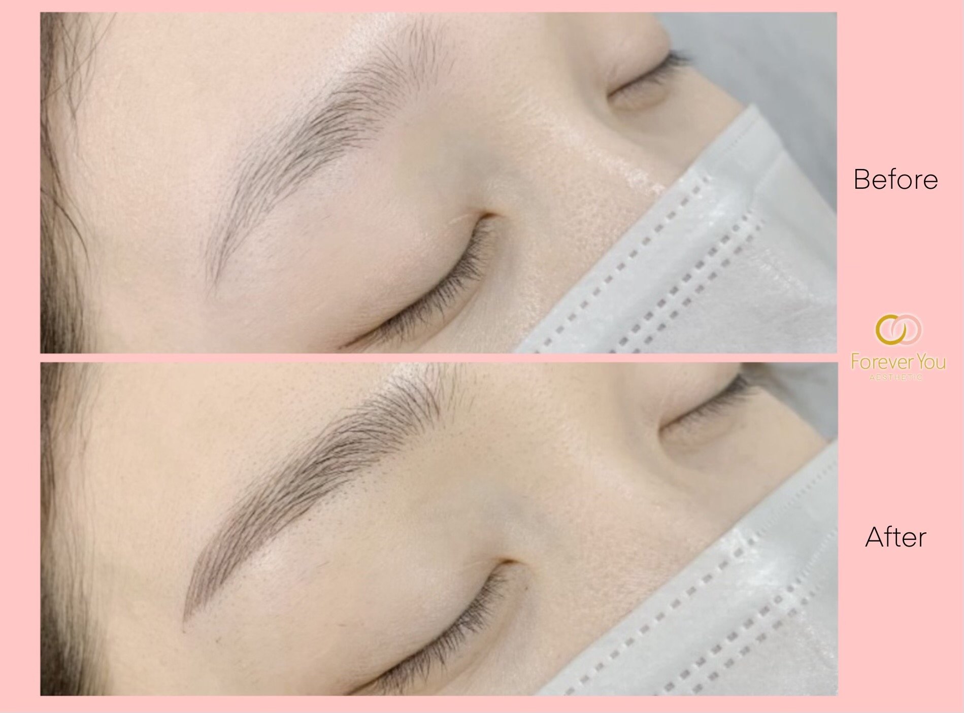 Microblading Forever You Aesthetic