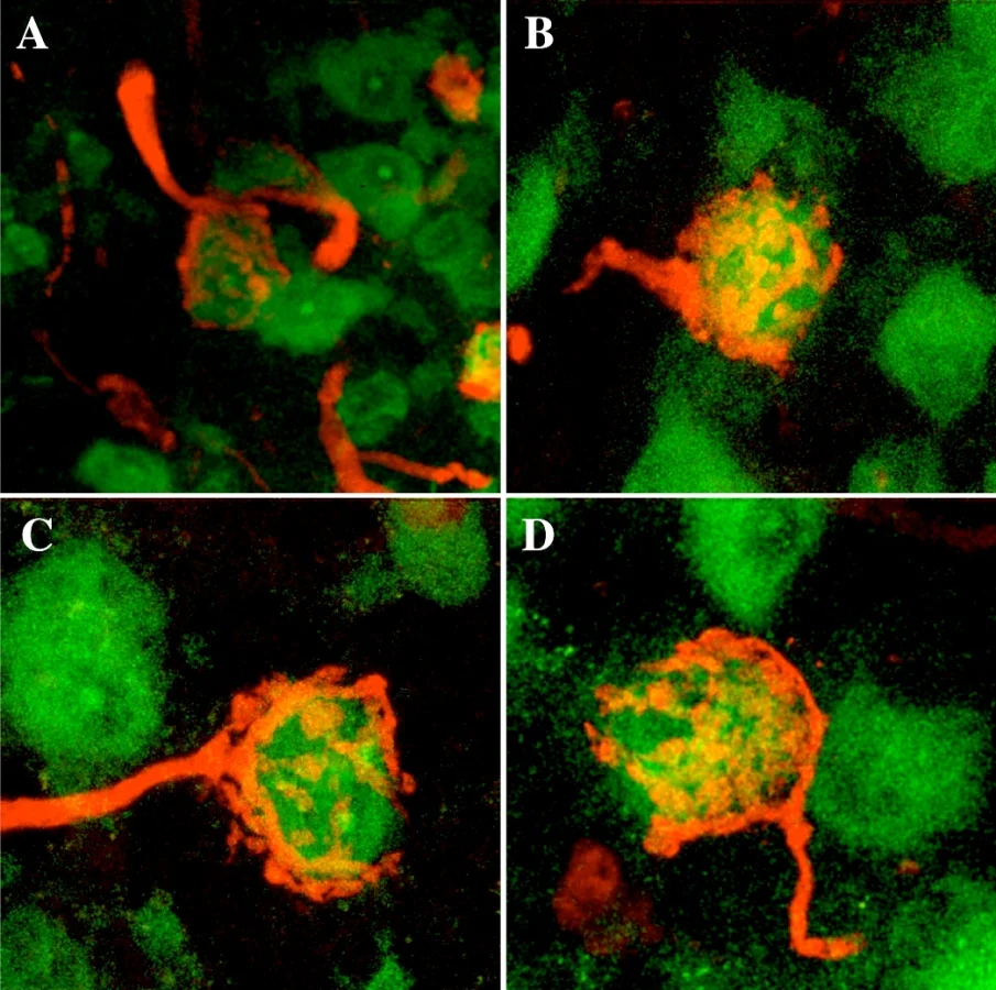 Image 1 Four images of different MNTB neurons (green) with afferent calyces of Held. The calyx of Held (orange) is a type of giant synapse, which synapses onto MNTB neurons and relays excitatory information to these neurons. The size of the synapse, its particular subcellular design, the location of ion channels, vesicles and receptors all contribute to the relaying of information across this synapse with extreme temporal precision. After receiving the excitatory inputs, the MNTB principal neurons in turn send inhibitory outputs to a number of targets in the auditory brain stem and thus act as a master source of well-timed inhibition for the lower auditory system, especially the sound localization pathway. Visualization of the calyx of Held via tracer injection (tetramethylrhodamine dextran) into the cochlear nucleus, MNTB neurons were labeled with fluorescent Nissl label.