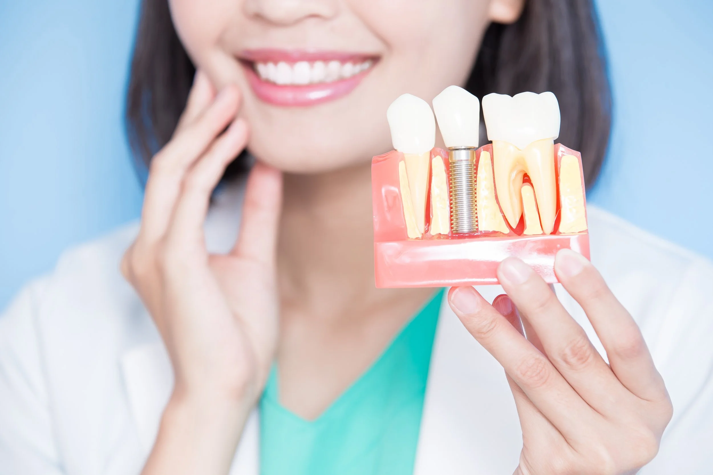 Dental Bridge Vs. Dental Implants