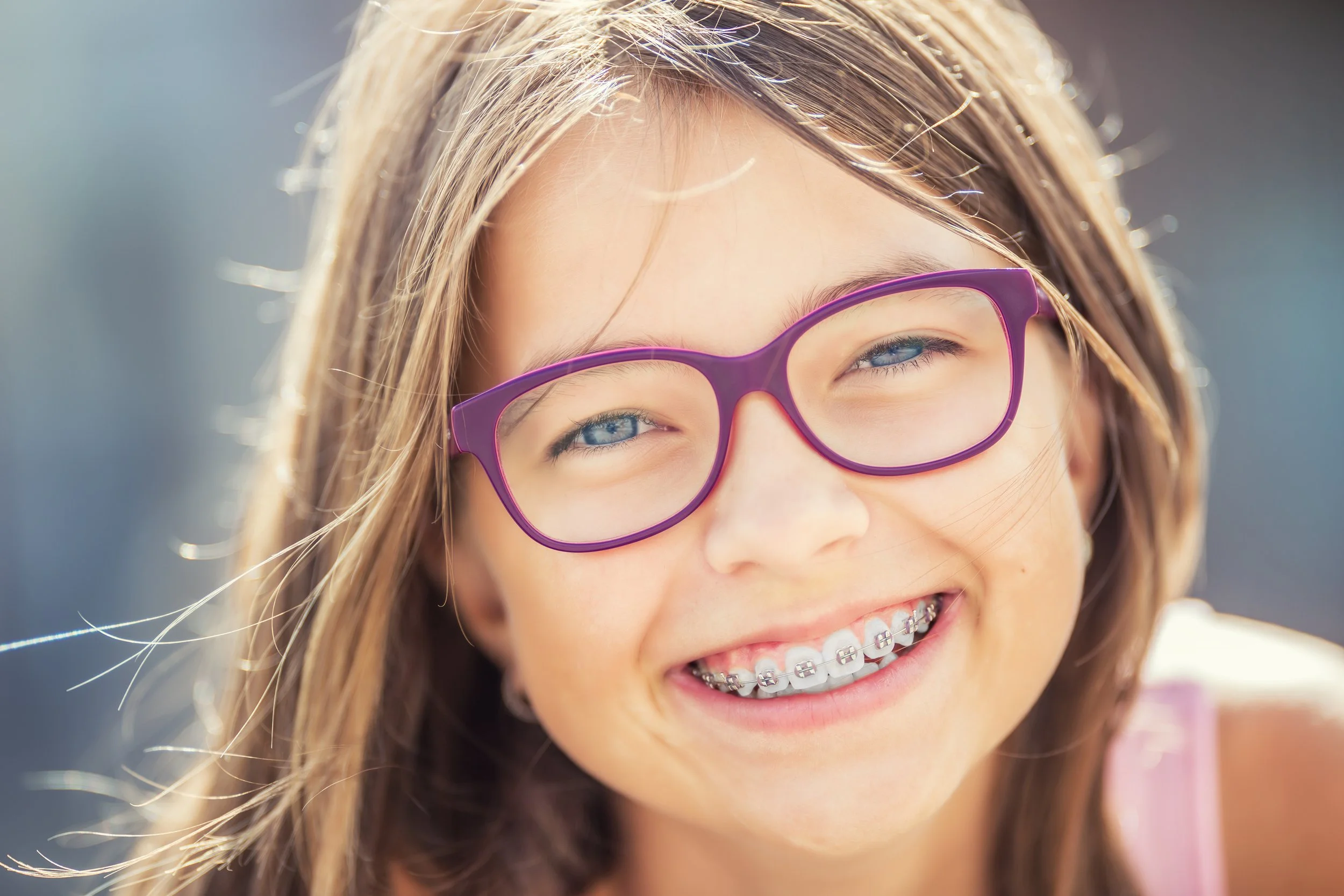 How Long Will I Have to Wear Braces?