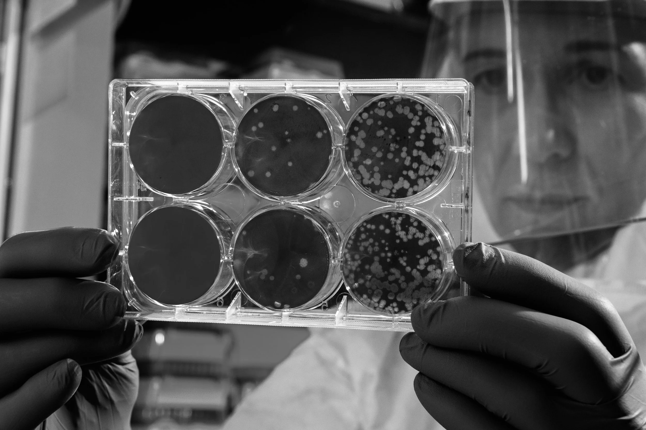 Nabiha Saklayen: Could lasers make stem cell therapy available to everyone?