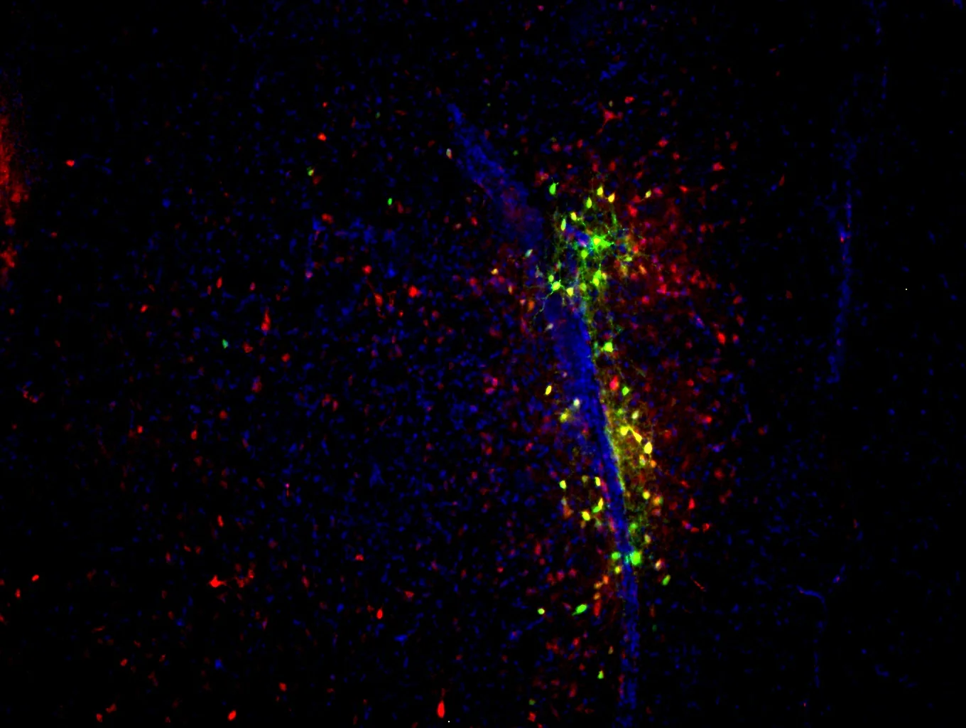 dapi.mcherry.gfp.overlay+RBV2ulAAV+well+8L.jpg