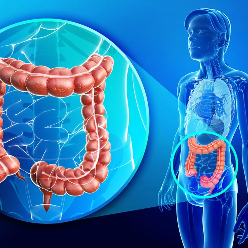 Episode 86: Rectal Cancer, Conventional Treatment and Cannabis Oil