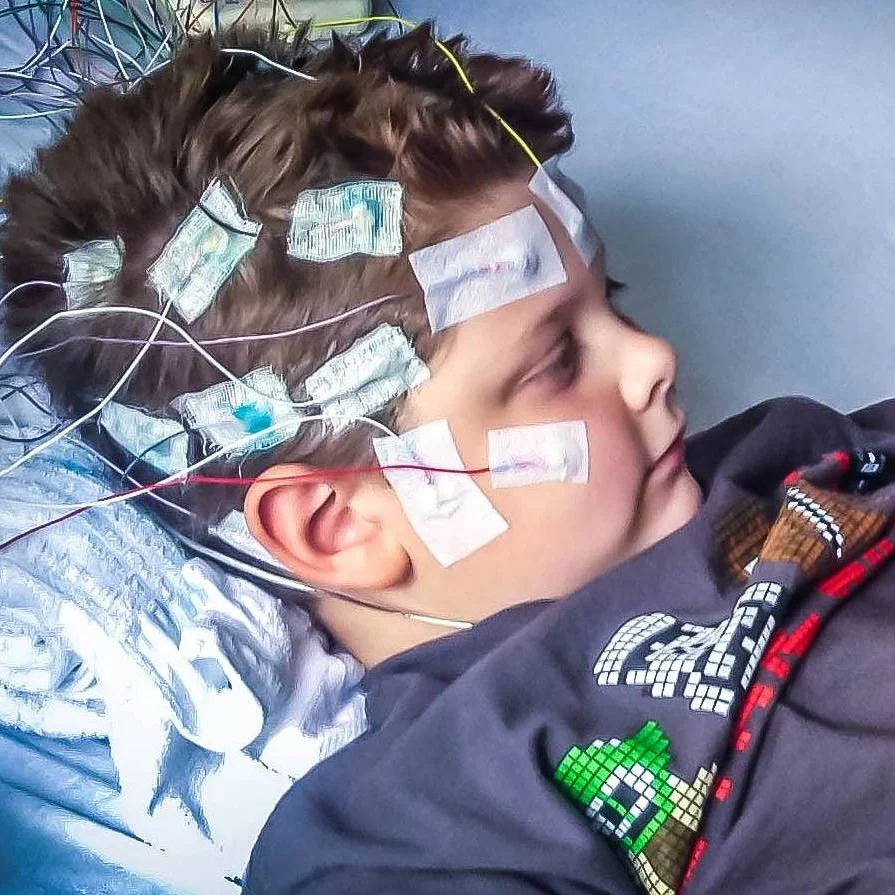 Episode 65: From 2500 Seizures a Month Without Cannabis to Zero With Cannabis
