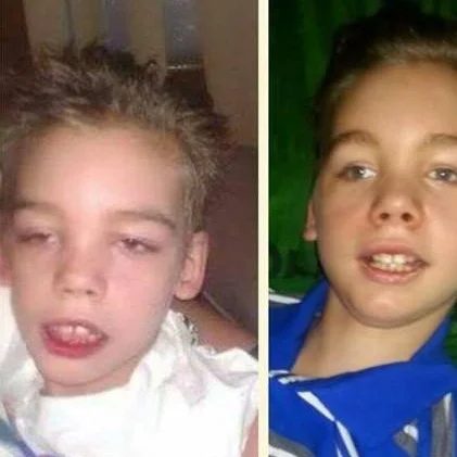 Episode 198: Her Son Was Born With A Rare Birth Defect Of The Brain. Cannabis is Providing Relief.