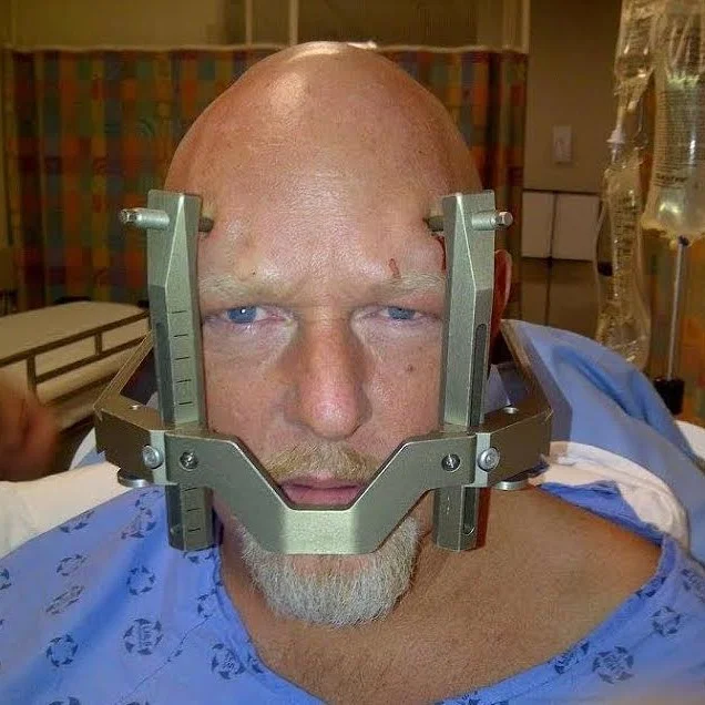 Episode 175: "Clusterhead Tom" Talks About The Intense Pain of Cluster Headaches