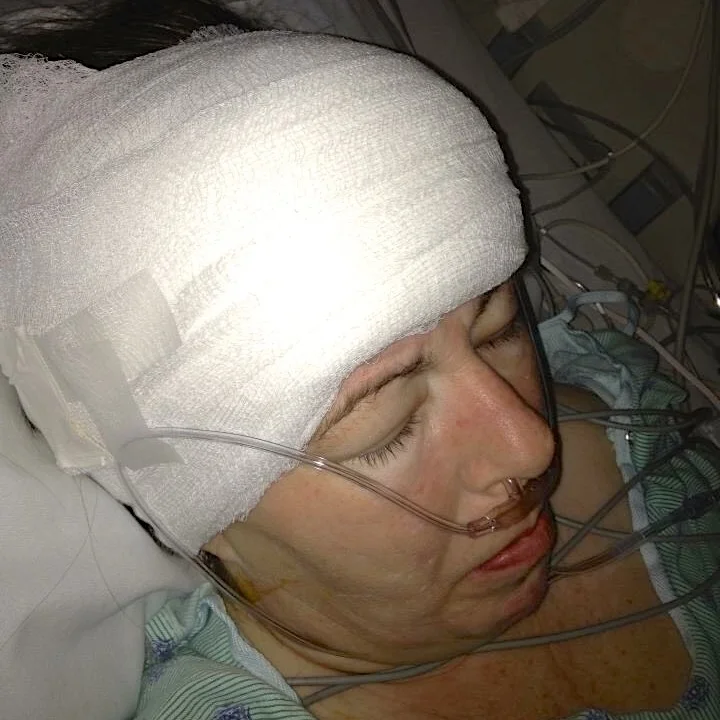 Episode 150: Cannabis Helps Woman With Structural Brain Defects