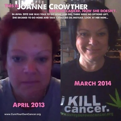 Episode 31: She Beat Cancer With Cannabis Oil, After Being Given 6 Weeks to Live