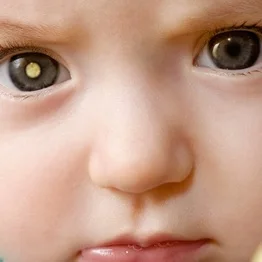 Episode 15: Four Month Old Baby with Cancer in Both Eyes Benefits from Cannabis Oil