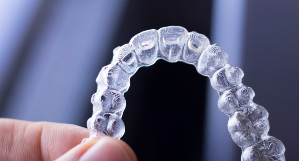Navigating the Invisalign Process: Achieving Your Perfect Smile