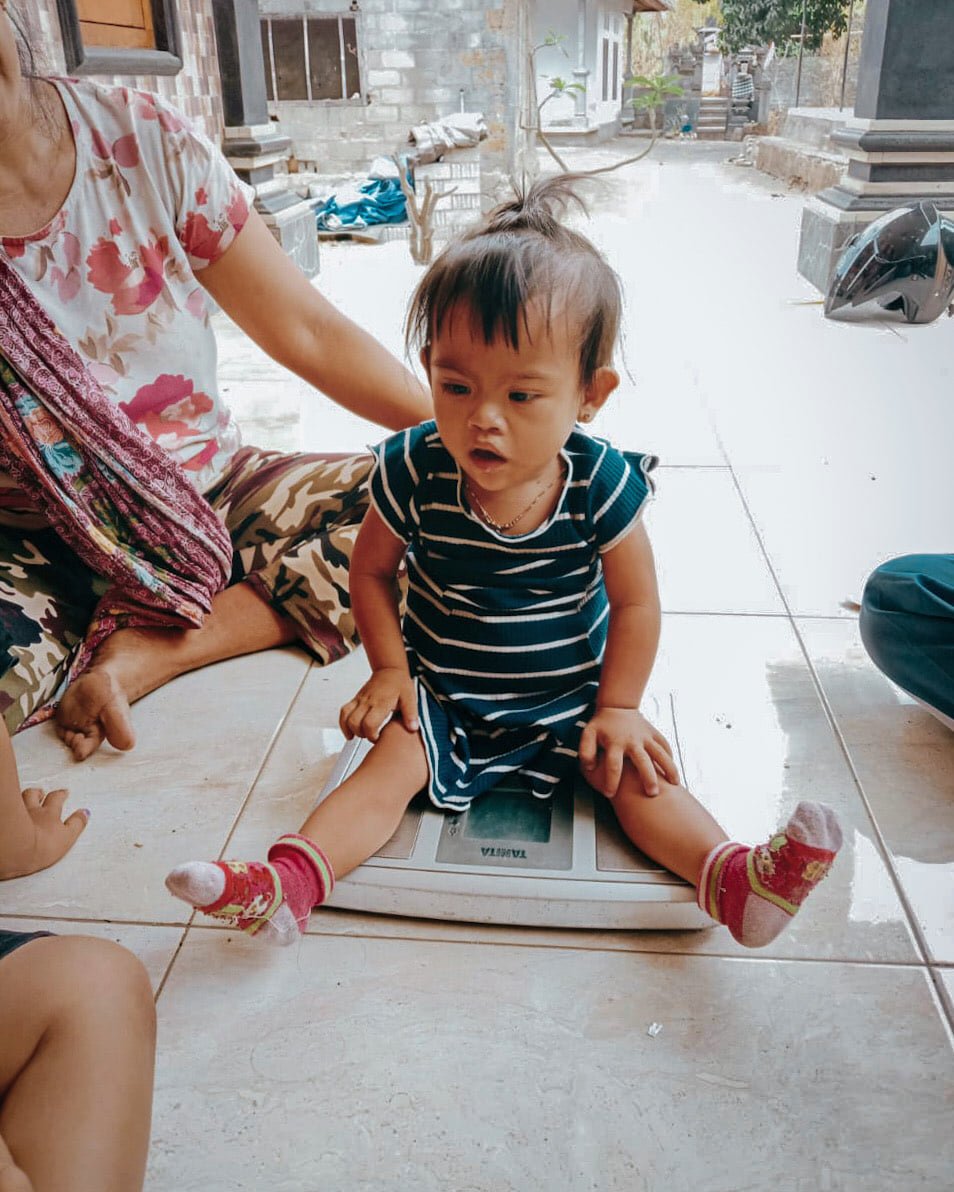 Nutritional Status Enhancement of Severely Malnourished Children