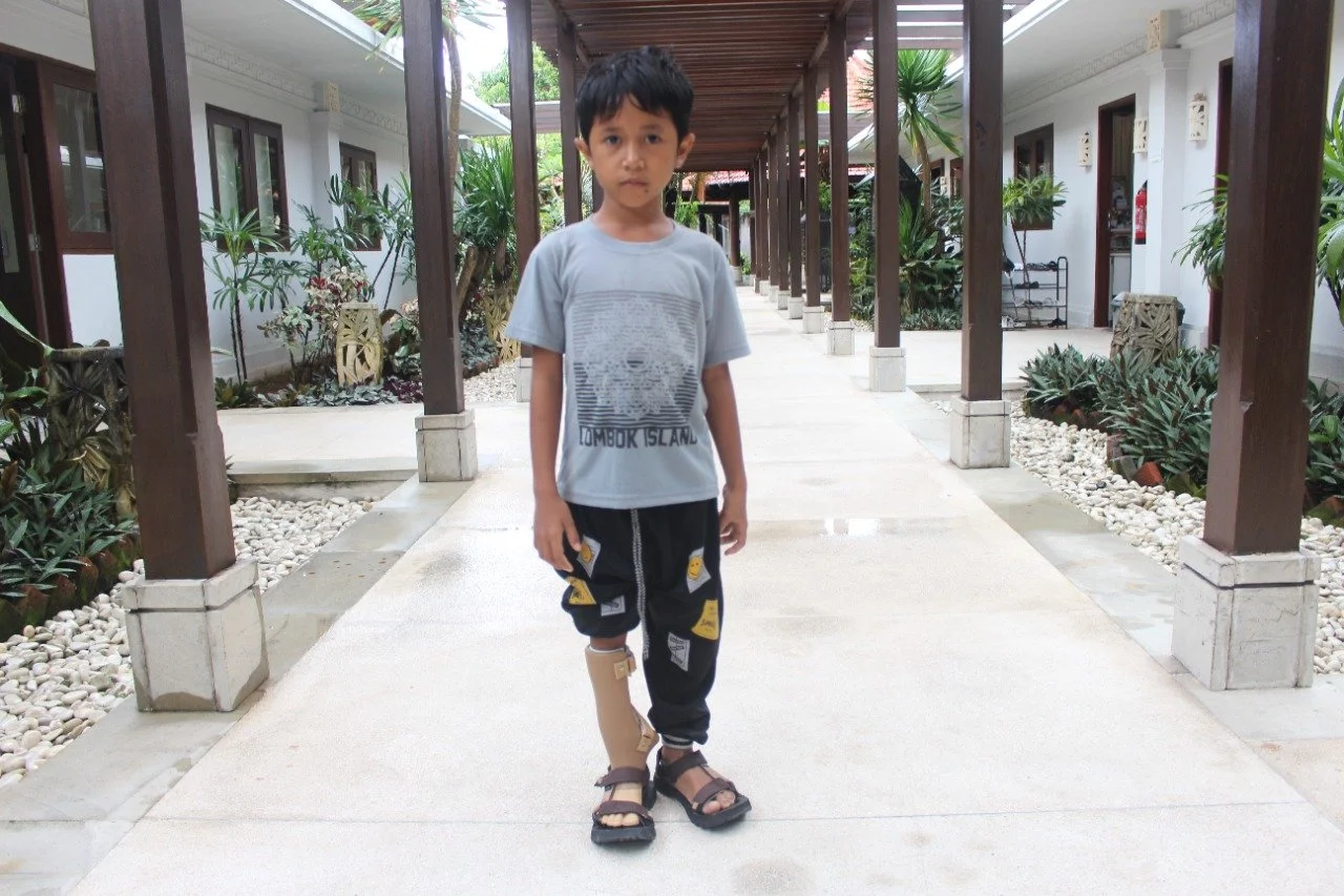 Ali gets a prosthetic leg and can start participating in sports lessons!