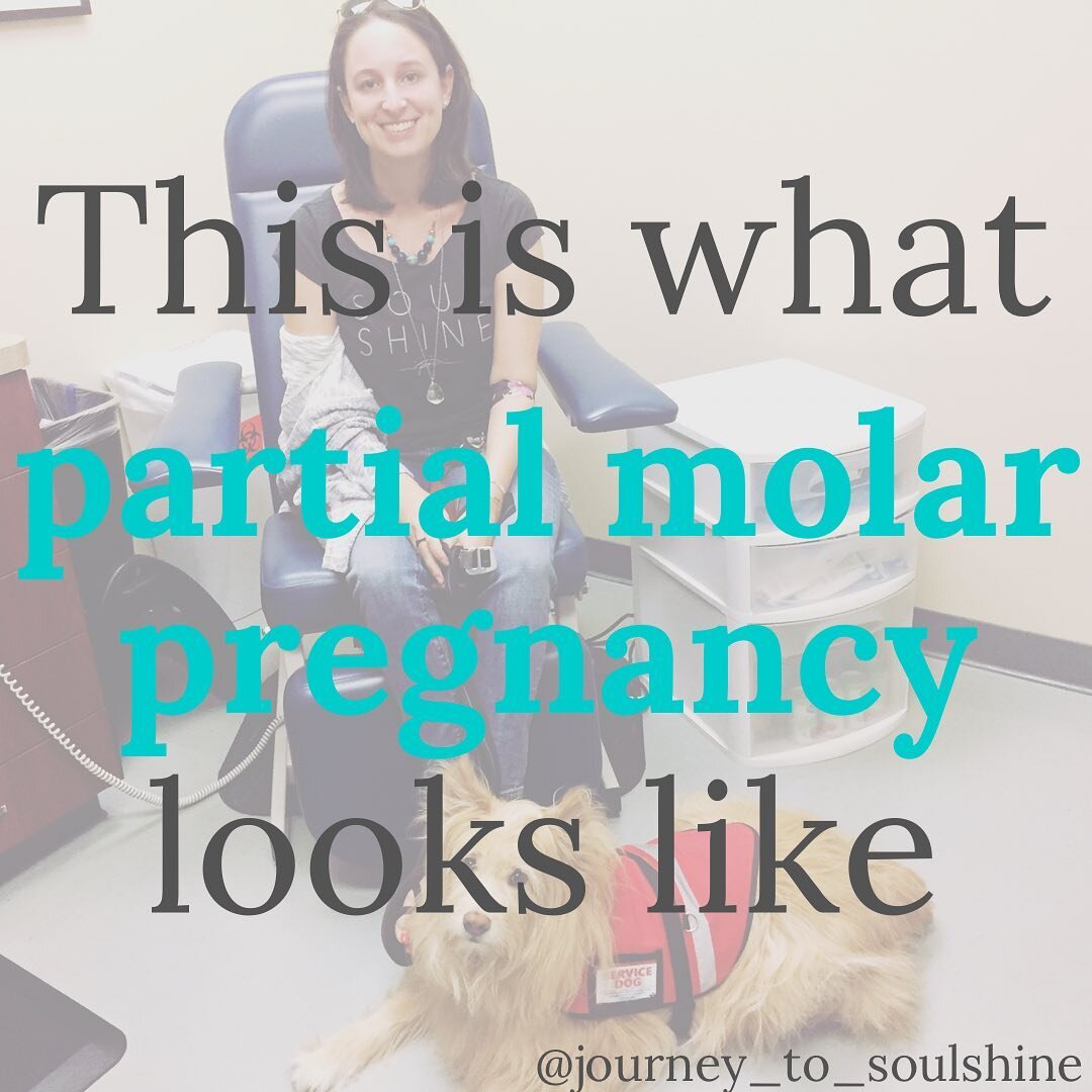 Being told I was at risk of cancer and needed chemo from a miscarriage (that wasn't connected to my several chronic illnesses) was the lowest point of my health journey 😞 

(2016) After we miscarried, I made an informed decision to have a D&amp;C, a