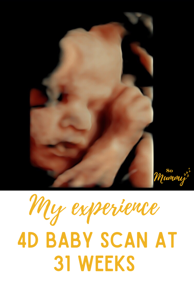 4d Baby Scan At 31 Weeks Somummy