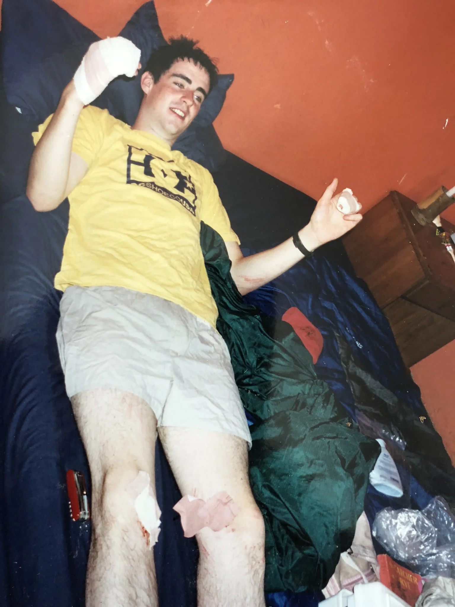  Younger, skinnier, injureder, Peadarer 