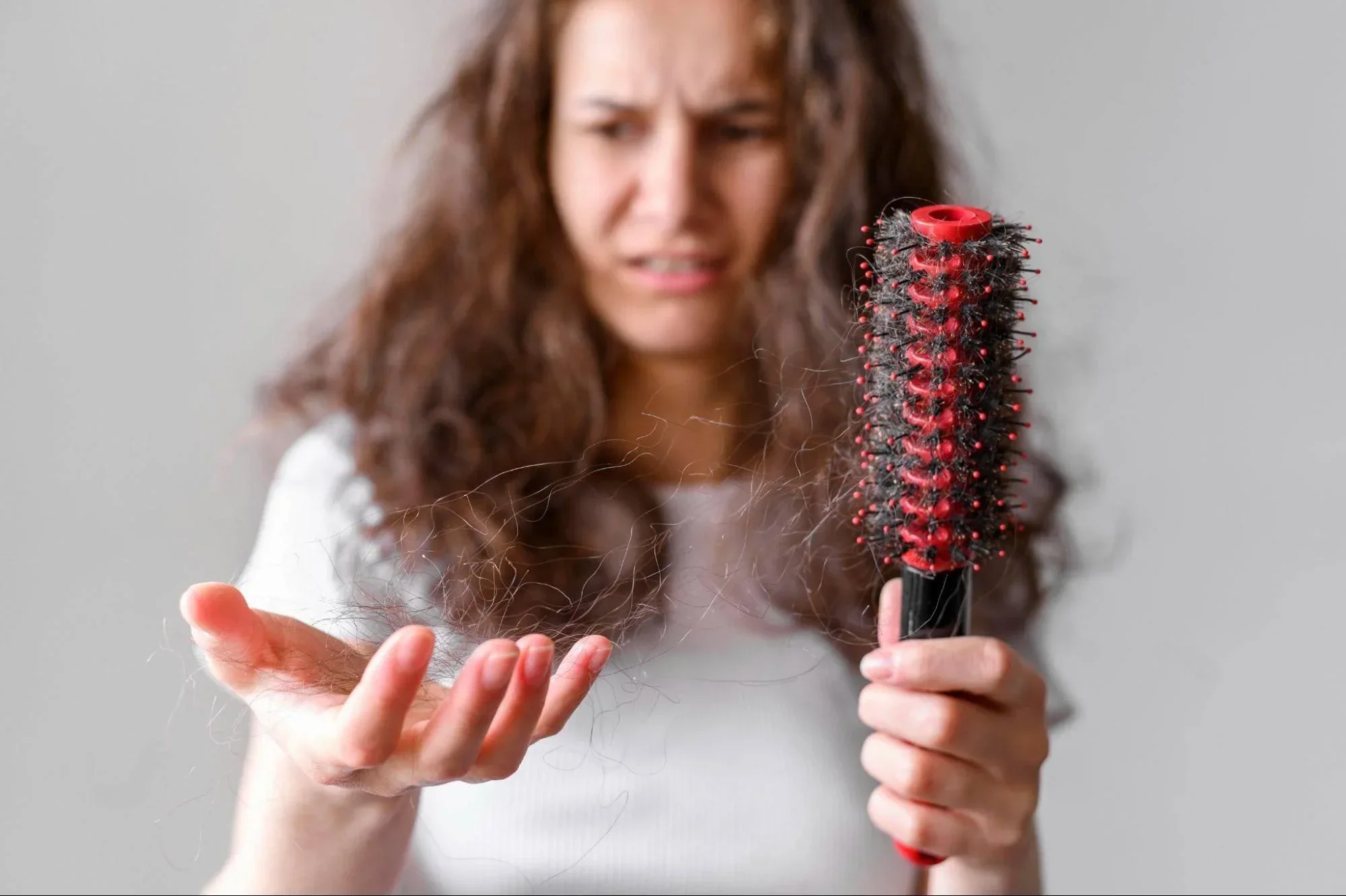Hair Loss in Women