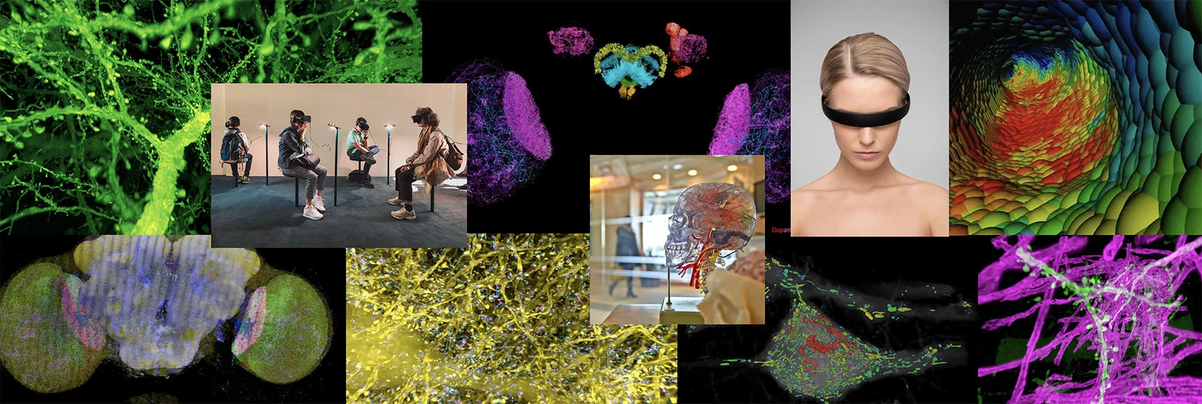 Expansion Microscopy Image Credit: Gao et al./ Science 2019