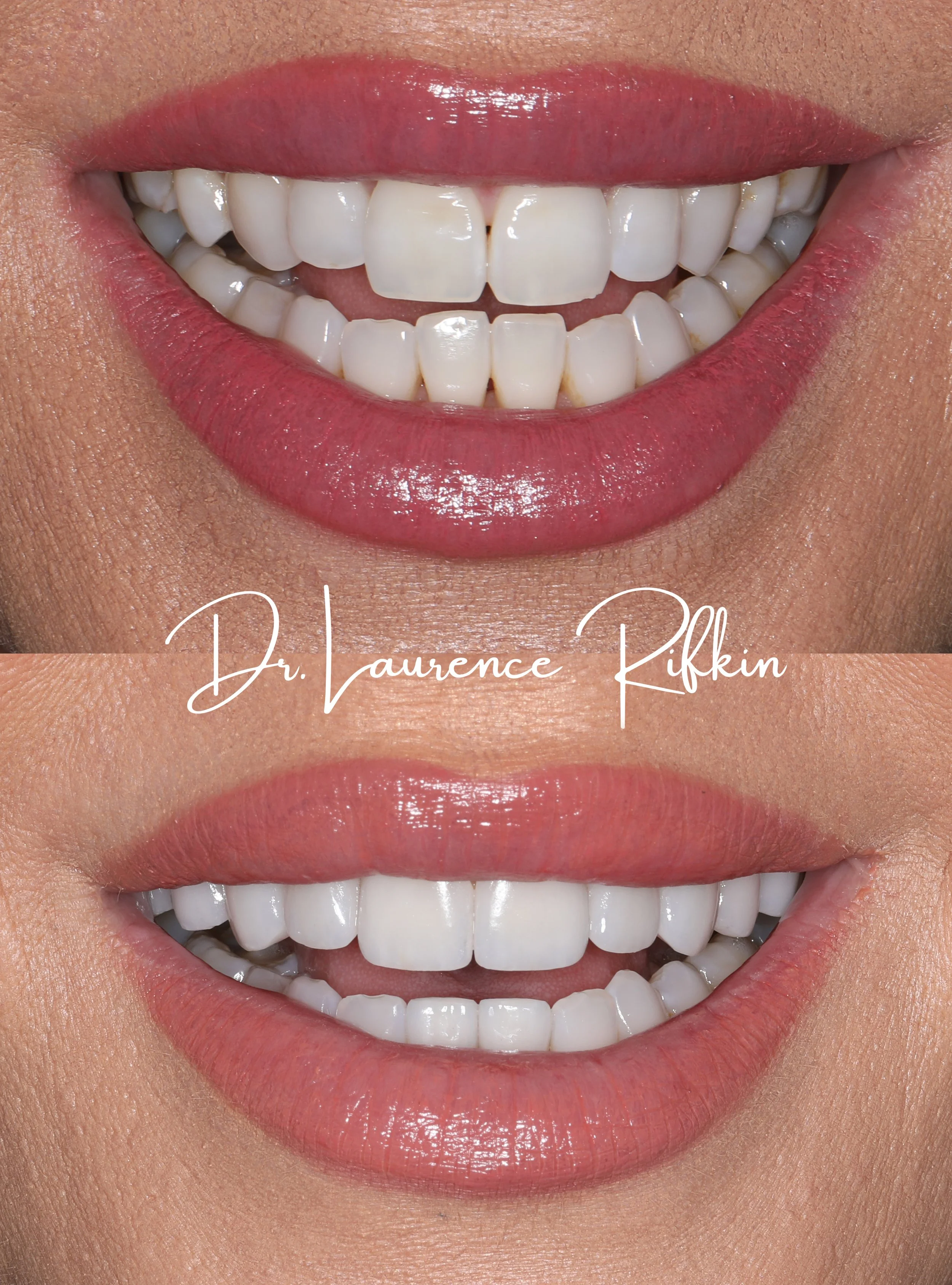 Lynn a Close up .jpg