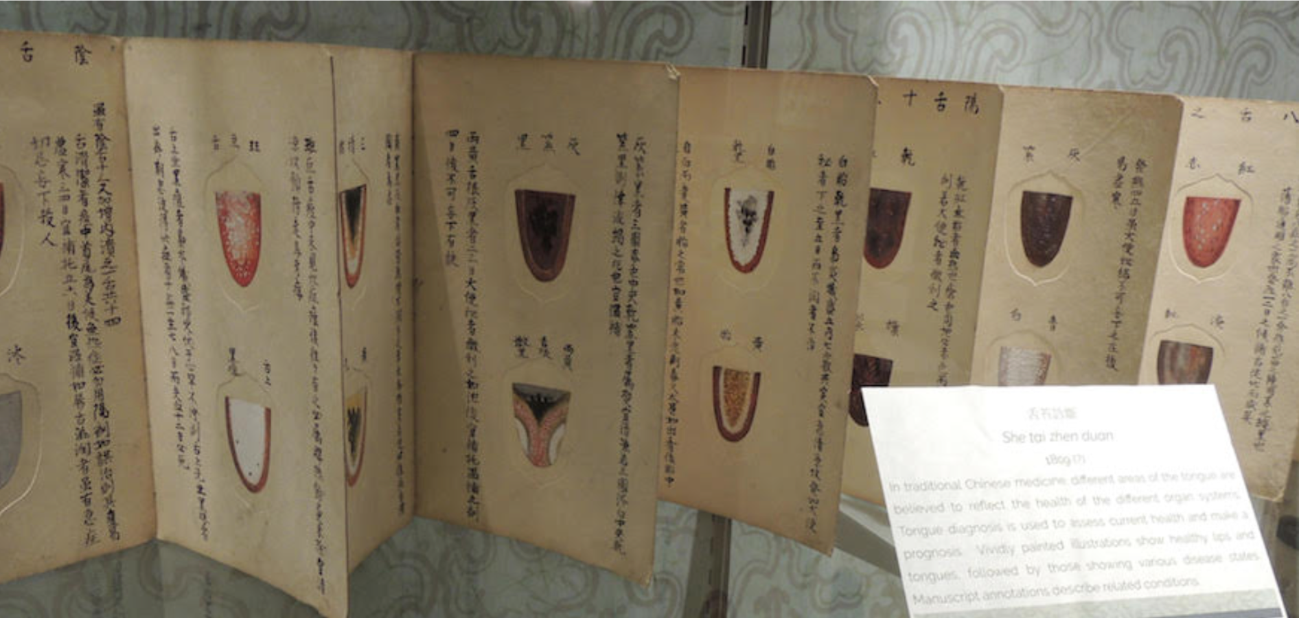 FM Helps Preserve and Protect Rare Books