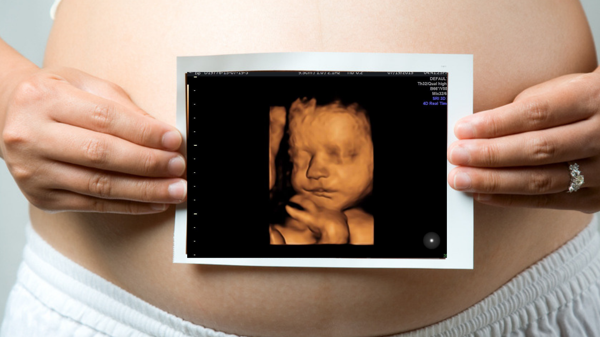 Hd 3d 4d Gender Ultrasounds In Kissimmee Florida Serving Orlando And All Of Central Florida By Babies First Glance