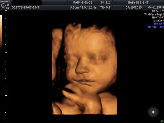 3d image.jpg