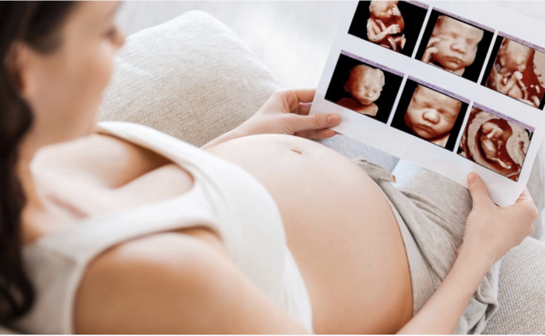 8K TrueView ultrasound image of baby at Babies First Glance Lake Nona Orlando