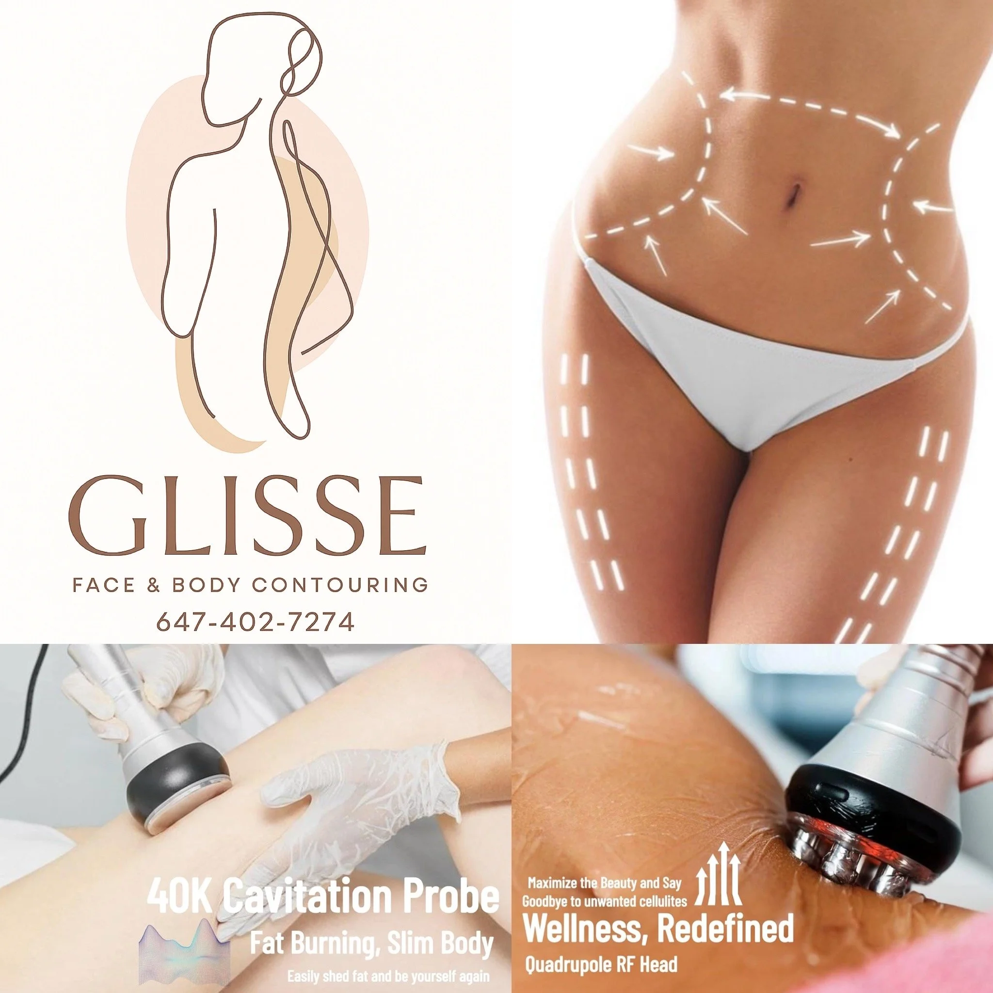 Glisse Face & Body Contouring - 4 Treatment package