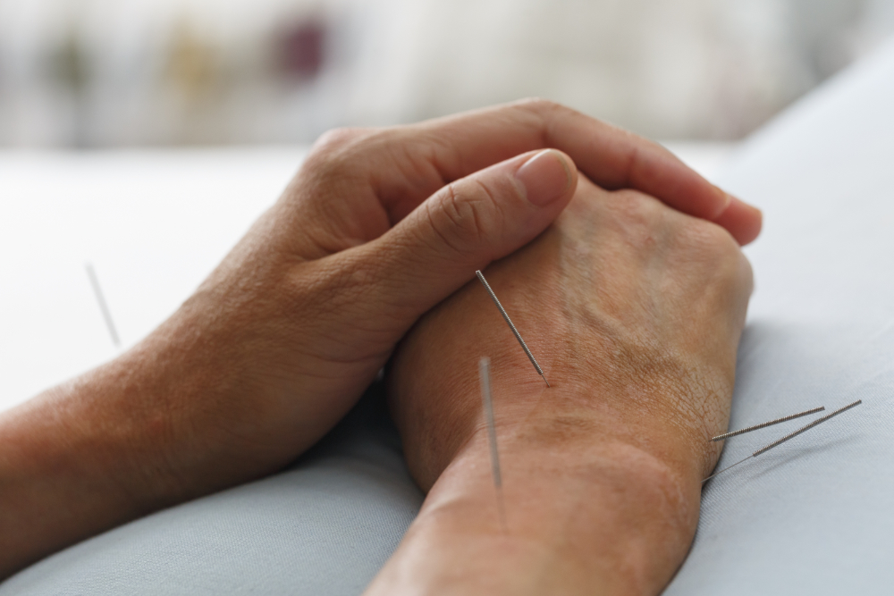 place-eight-acupuncture-services.jpg