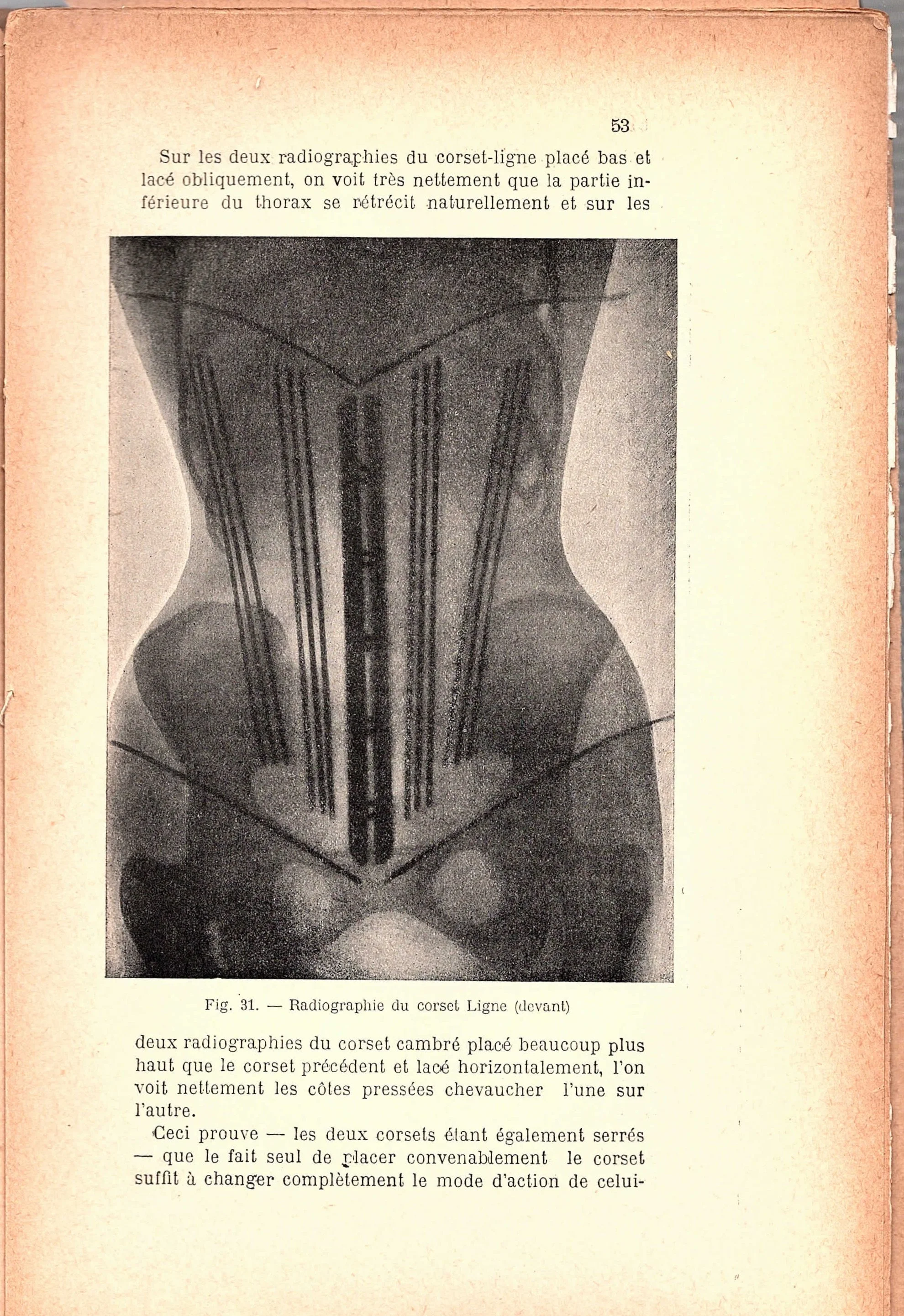Why Do We Keep Trying to Kill the Corset? Rehabilitating a Controversial Garment Through Feminism and Bioanthropology