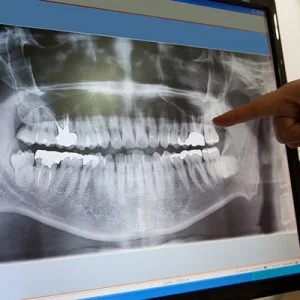 dental-xrays-square-2-300x300.jpg