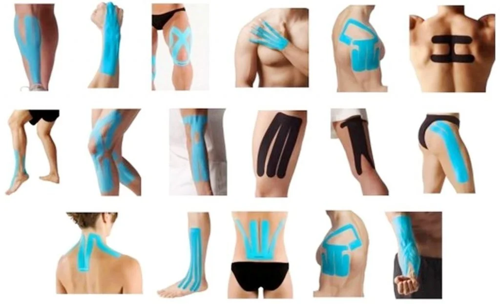 What is Kinesio Tape?