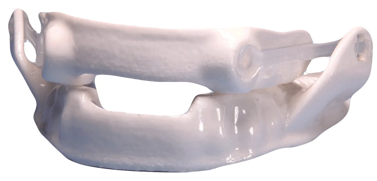 Understanding Oral Appliance Therapy