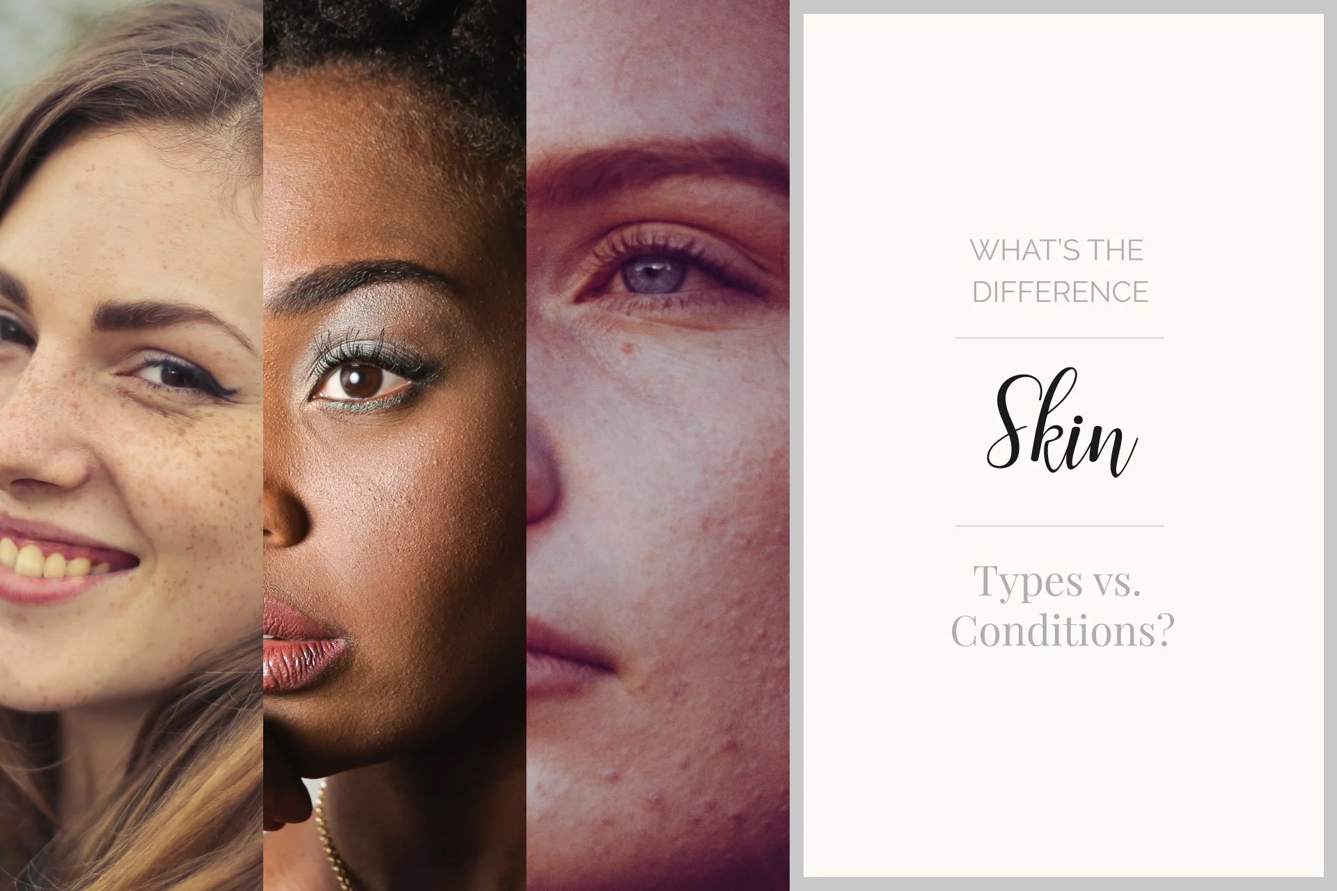 Skin Conditions vs Skin Types:  What is the Difference