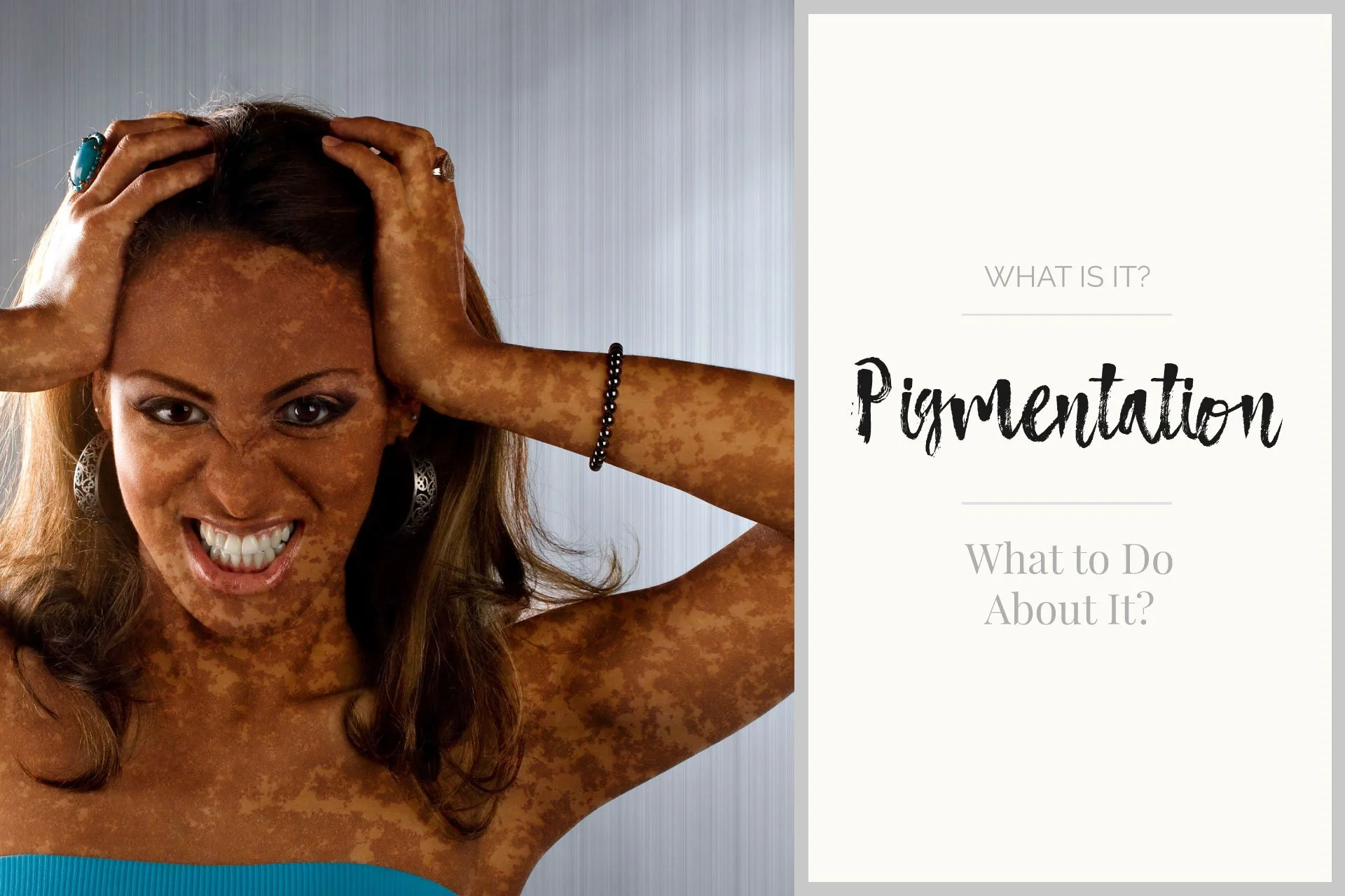Pigmentation: What Is It and What to Do About It