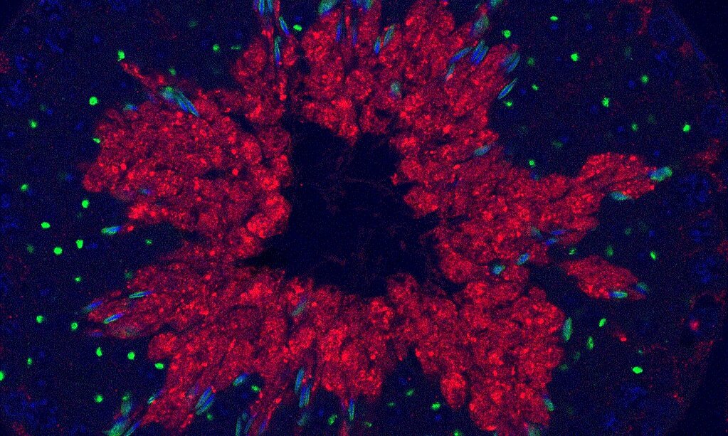  Image is a cross section of mouse seminiferous tubules / testis stained for nuclei (blue via DAPI), acrosomes (green via PNA) and ACRV1 (red) 